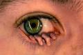 Avatar de FOXTROT